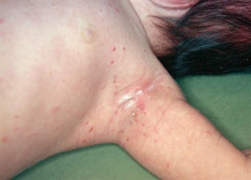 Vilken diagnos?