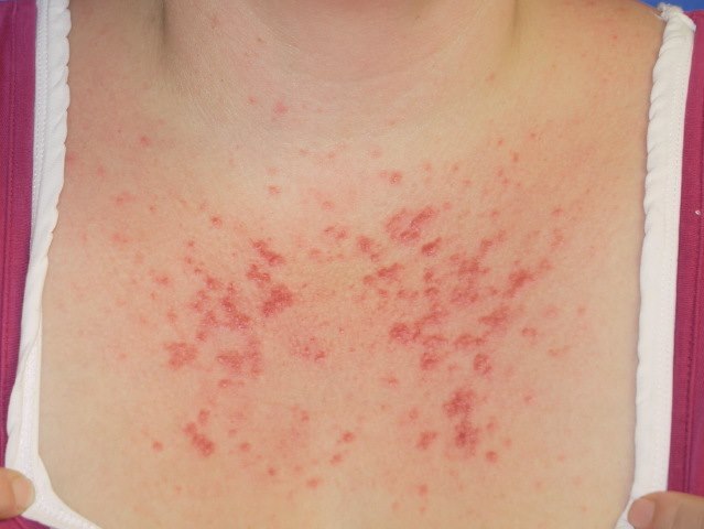 Vilken diagnos?