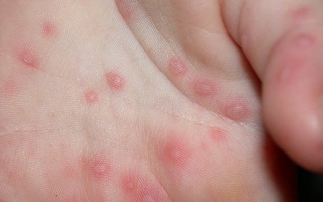 Vilken diagnos?
